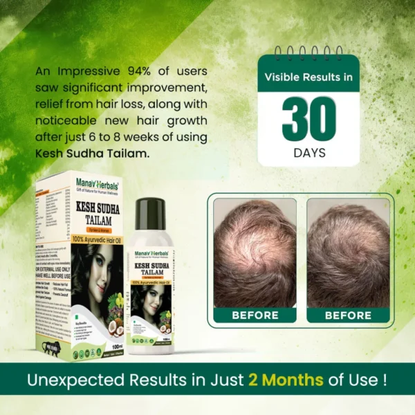 Kesh Sudha Tailam Kit, incuding 100ml Pure Ayrvedic Hair Oil With 30 Ayurvedic Capsules For Strong & Healthy Hair For Men & Women - Image 7
